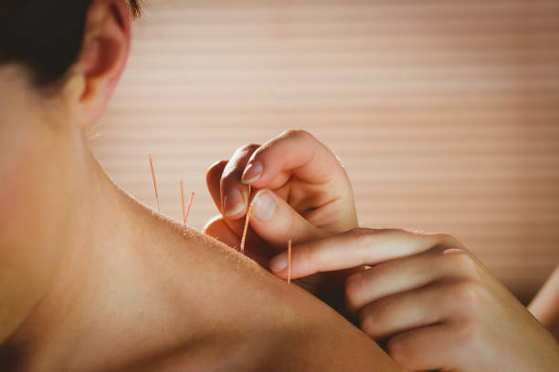 Acupuncture in Atitlan 4